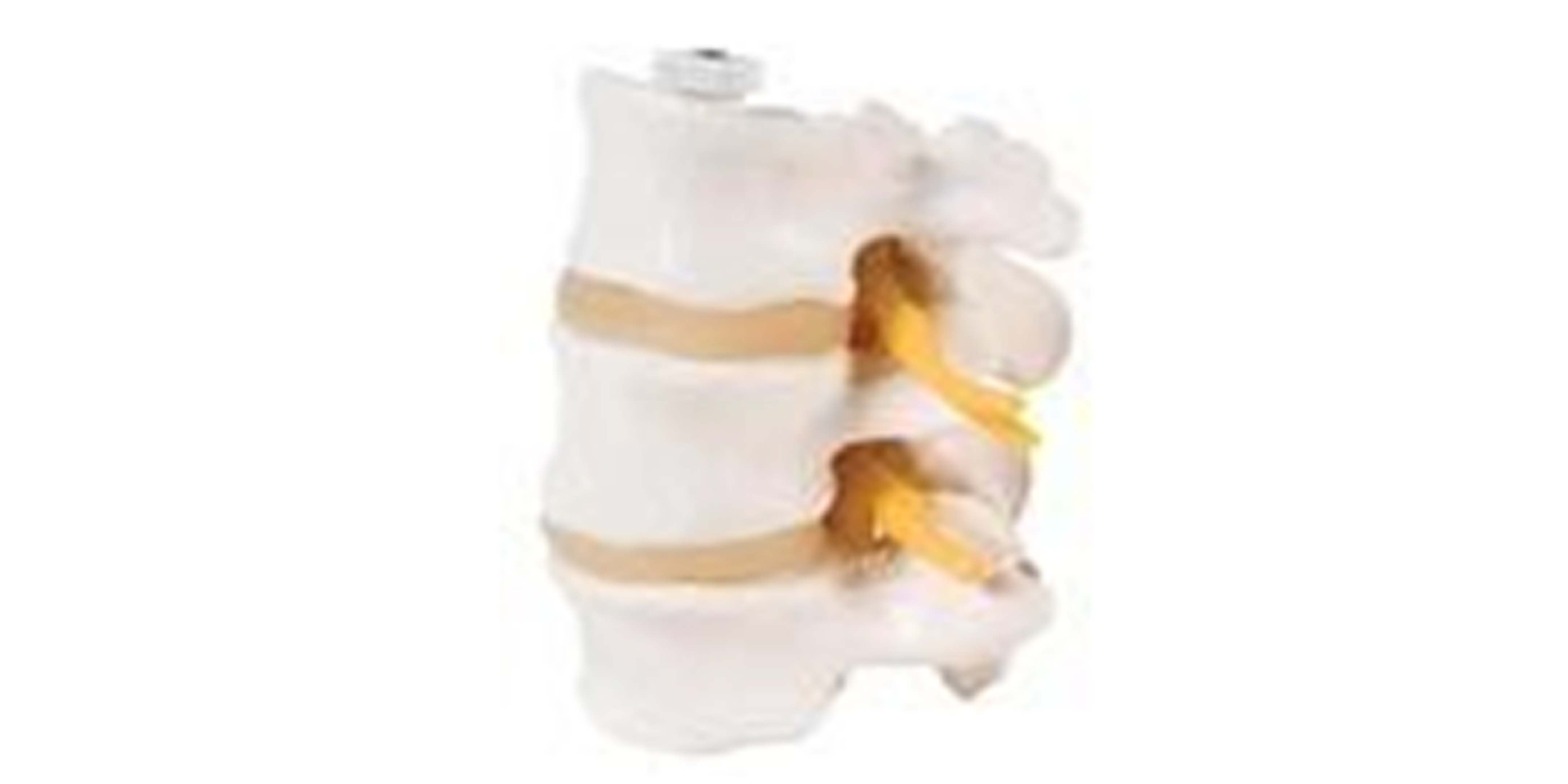 Budget Lumbar Vertebrane.jpg