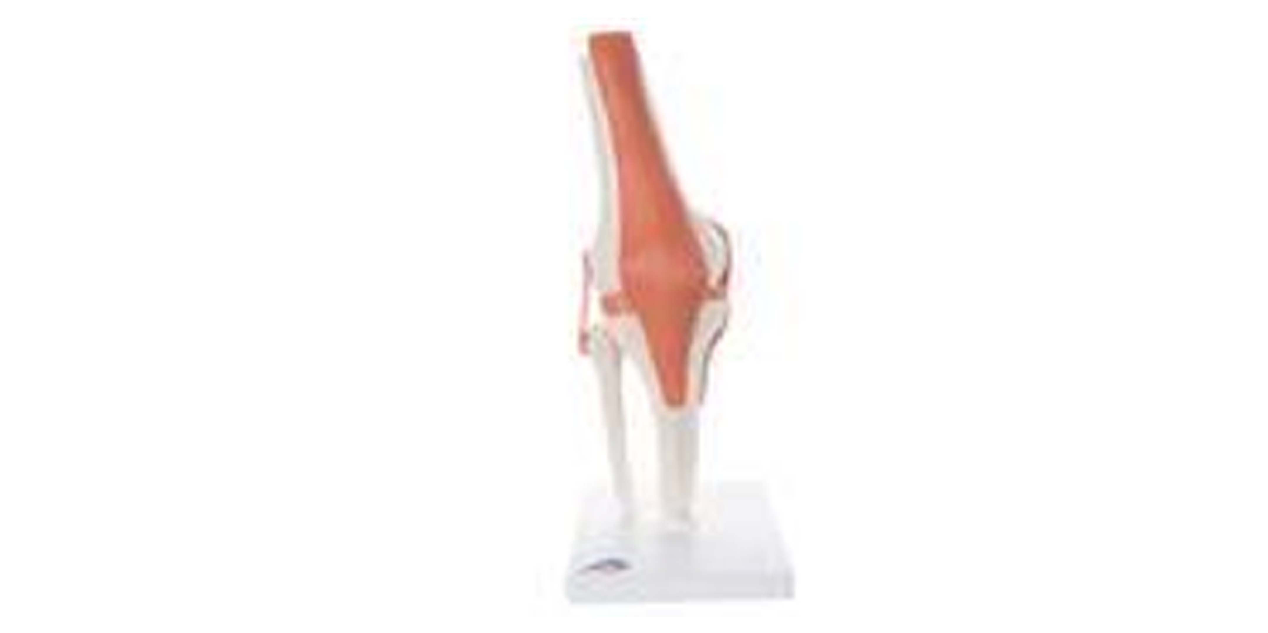 Functional Knee Joint Model.jpg