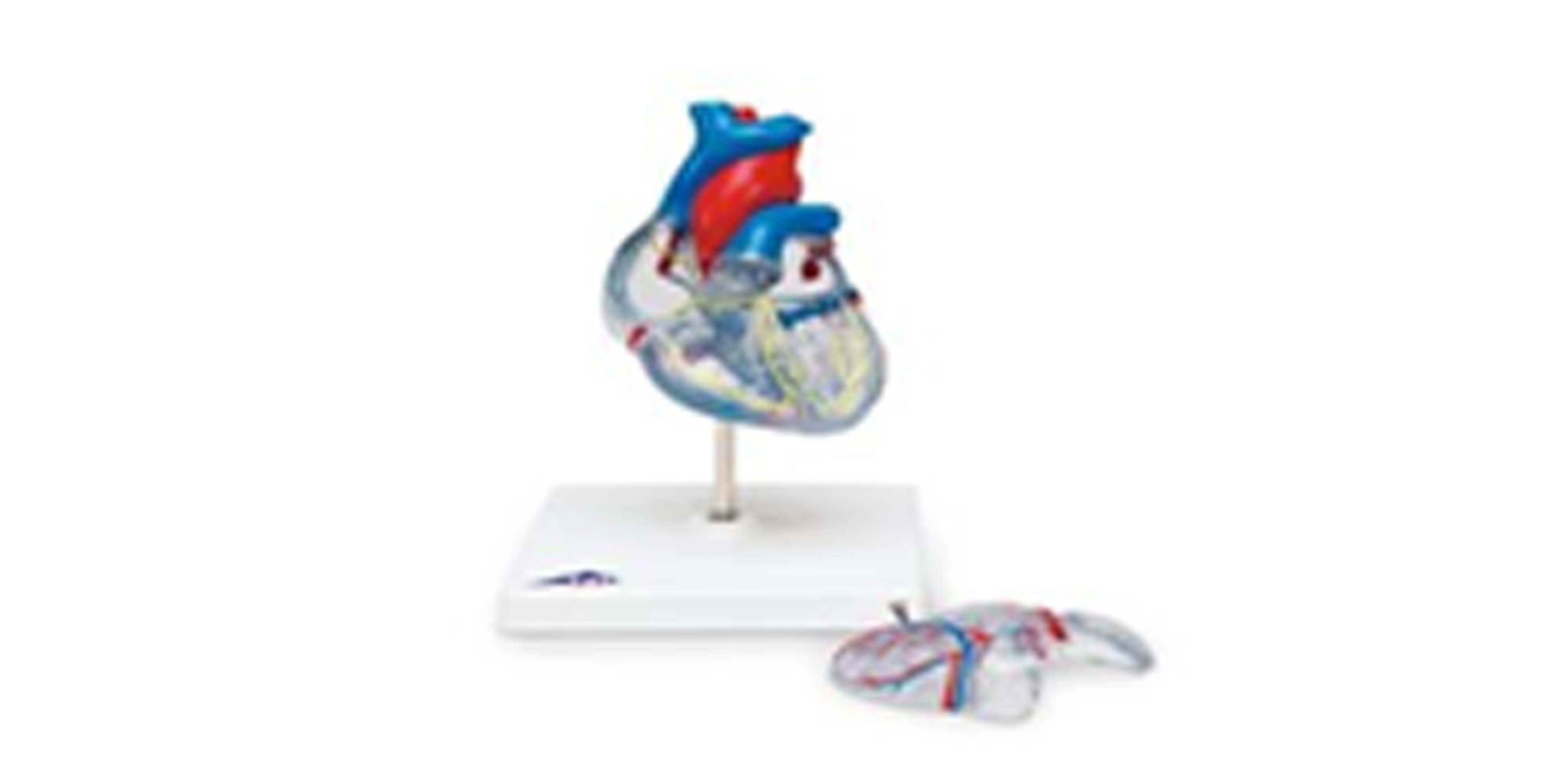 Heart and Great Vessel w Conginential.jpg